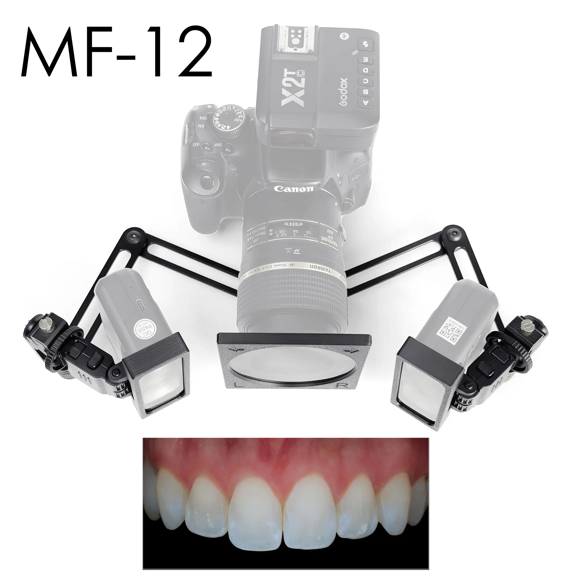 Photography Lighting Kit Godox - Godox MF12 Flash Filter Set For