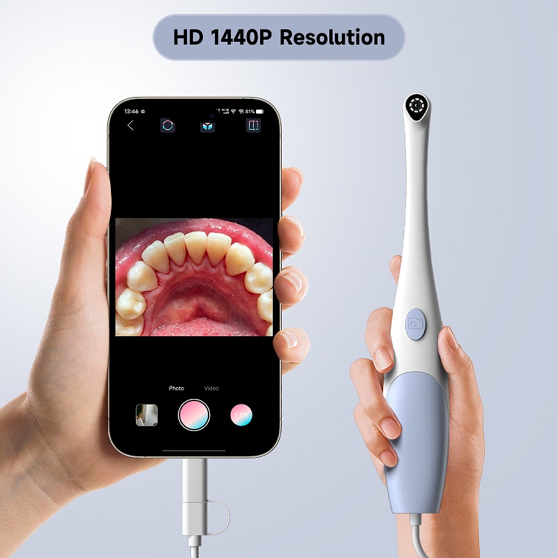 Oral Endoscope Camera 1440P Ph - Photography Lighting Effects review and price