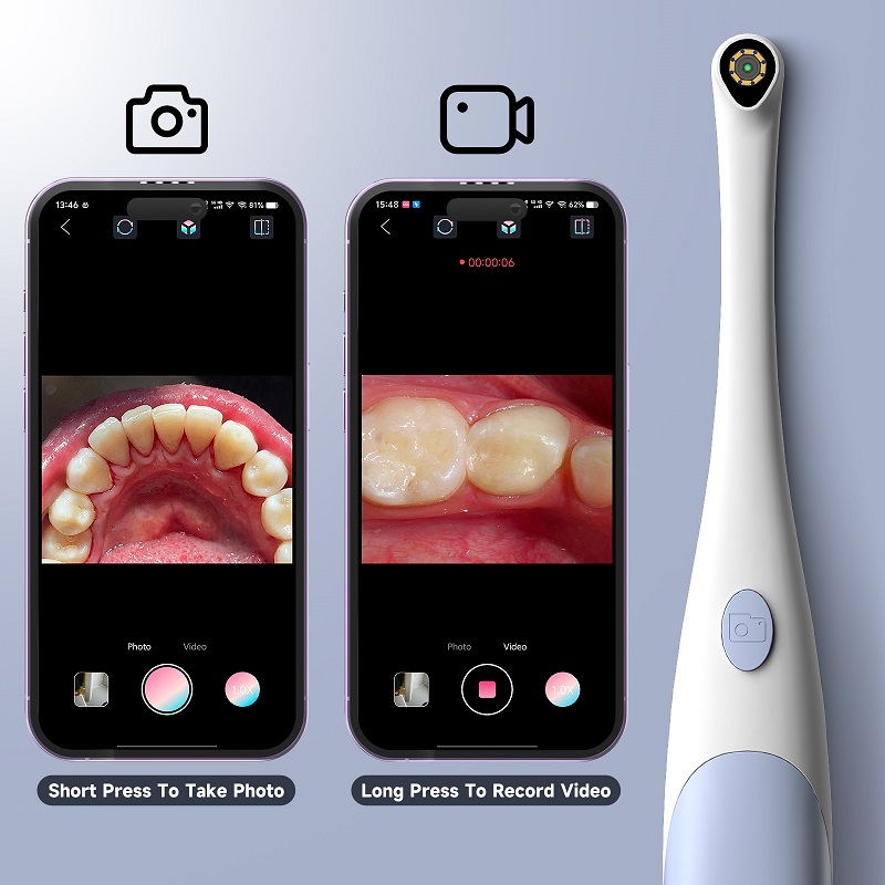 Oral Endoscope Camera 1440P Ph - Photography Lighting Effects review and price